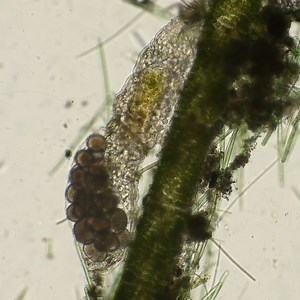 53K views · 547 reactions | Being a momma #waterbear means you have to walk around with between 1 and 30 eggs at a time. Just in case you thought it was all fun and games surviving in extreme conditions. #MicroscopicMonday  | Science Channel | Facebook