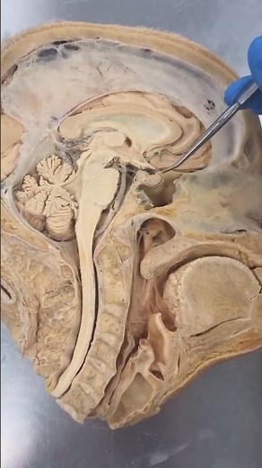 REAL Human Pituitary Gland