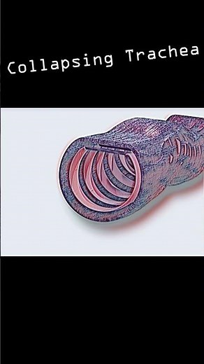 Collapsing Trachea in dogs #shorts