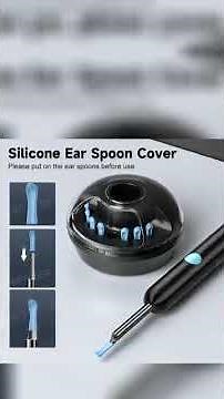 Is This the Future of Ear Cleaning? The Smart Camera You NEED! 👂💥