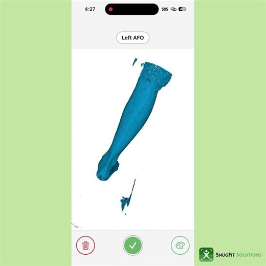 AFO Scan using SnugFit Stand