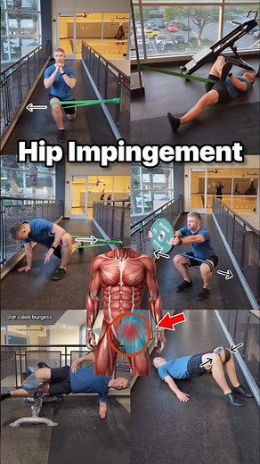 Hip Impingement - Rehab Exercises