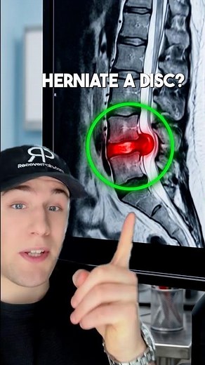 ⚡️ Herniated Disc?? Do This #backpain