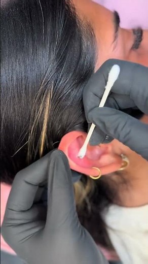 How to Get Rid of a Piercing Bump | Aftercare Routine That Works 💧