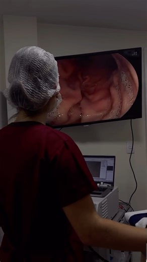 DRA. CAROLINA GONÇALVES on Instagram: "Endoscopia Digestiva Alta associada a Limpeza Bucal! Além de otimizar o tempo anestésico, conseguimos unir diagnóstico e tratamento em um único momento, trazendo mais segurança. Nosso paciente cardiopata recebendo um tratamento integrado com uma equipe preparada, alinhada e comprometida com a medicina veterinária de qualidade ❤️‍🩹 @centrointensivovet @marcellasampaioo @marfim.odontovet @juliavulpe @thais.assumpcao"