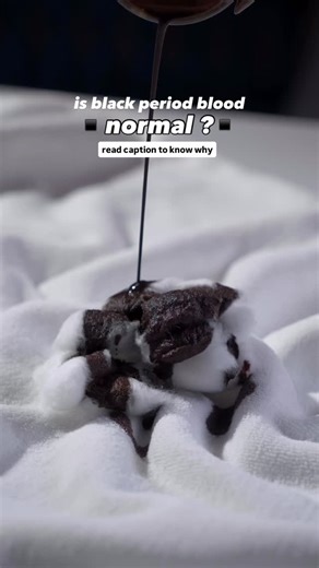Healthfab on Instagram: "Black or very dark period blood is usually just old blood that took longer to leave the uterus. As blood sits longer, it oxidizes and turns darker. This is common at the start or end of your period and is usually nothing to worry about. If it’s accompanied by severe pain, foul smell, fever, or unusual discharge, check with a doctor. Otherwise, it’s a normal part of how periods can look. So yes , it’s totally normal 🖤 . . . . . [black periods normal periods education hea