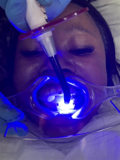 Braces Installation Vlog: A Day With Challenges