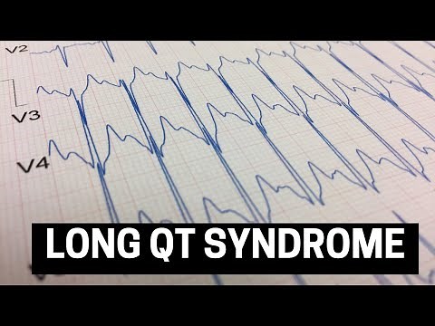 Understanding Long QT Syndrome (LQTS): Symptoms, Diagnosis, & Treatment
