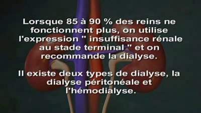 Épuration extra-rénale : définition, technique