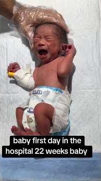 Baby first day in the hospital 22 weeks baby #babyshorts #babycaretips #babycare #newbornbaby