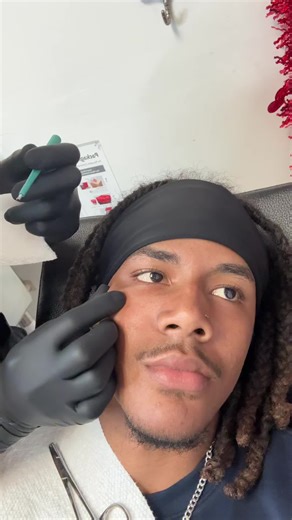 Experiencing Dermal Procedures: What to Expect