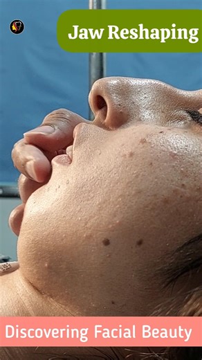 chin and jaw surgery | Best results