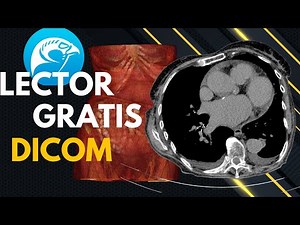 HOW TO OPEN A STUDIO IN DICOM FORMAT?