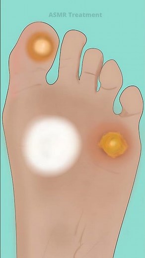 Foot ASMR Treatment Satisfying Animation