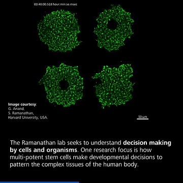 The Ramanathan lab at Harvard University (USA) seeks to understand decision making by cells and organisms. One research focus is how multi-potent stem cells make developmental decisions to pattern the complex tissues of the human body. Human pluripotent stem cells are a valuable tool to study cell differentiation. As they can re-new indefinitely as well as develop into every other cell type in the body, they hold the potential to replace damaged or diseased cells making them a promising tool for