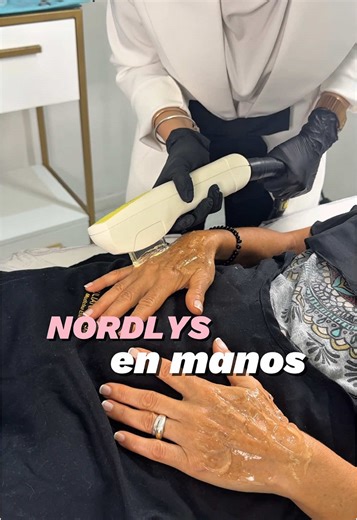 Tratamiento Efectivo para Manchas en las Manos con IPL