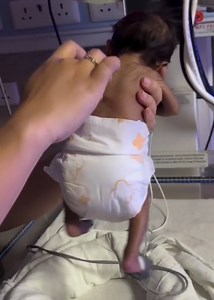 If the spinal Galant fails to integrate at the 6 month mark, the child may present the following once they reach school-age: ADHD-like symptoms Struggles understanding instructions received verbally or written Poor concentration skills Wriggles/remains unsettled when having to sit quietly Prefers to lay on the floor when completing homework or watching TV Wets the bed after being potty-trained Has no interest in playing sports or other physically engaging activities Prefers wearing loose fitting