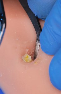 Professional-Grade Callus Removal | 5-Minute Crafts SHORTS