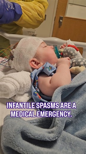 Miri Baum on Instagram: "Share this- you might save a baby 🧠 Infantile spasms don't always look dramatic. They can be subtle jerking movements, head drop, eye rolls etc - if something feels off, record it and get an EEG asap. Awareness saves time- and time matters. 🧠 Infantile Spasm Awareness Week: December 1-7 🧠 Infantile Spasm (West Syndrome) affects about 2500 babies in the US every year. Its a rare form of epilepsy that most often begins around 3-12 months old. Primar