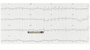 250429 - TTR - High- Yield Radiology