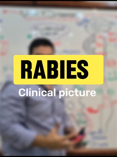 اي الي بحصل للناس المصابين بمرض السعار ؟ . . . . . .. . . .. . . #medicalstudent #علم_الامراض #pathology #elnemr #طب