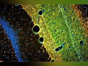 Biosensis 即用型 Fluoro-Jade C（FJC）试剂盒