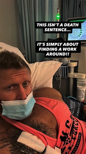 Stefan Estment on Instagram: "Training with a fistula. No excuses. No bullshit. Just precision. This is what a working AV fistula looks like: • At rest • Under load • During and Post-session pump As a natural bodybuilder on dialysis for the past 3-4 years, training hasn’t been about ego, and trust me when I say that it used to be, it’s about respecting the access that keeps me alive. That weird looking vascular portal is all I have keeping me topside, so there are no games here. I blow this thin