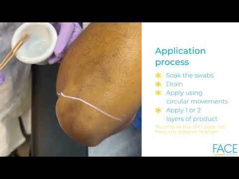 Intimate Lightening Demo