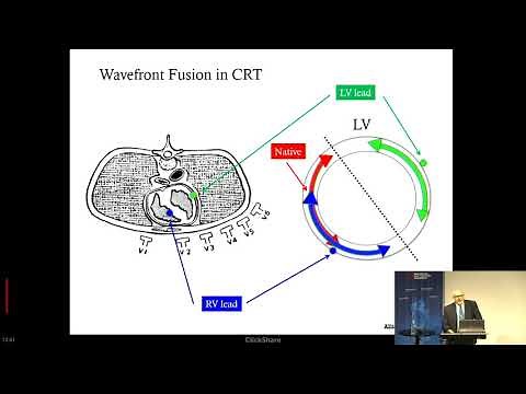 Alan Bank, MD | Electrical Dyssynchrony and Cardiac Resynchronization Therapy