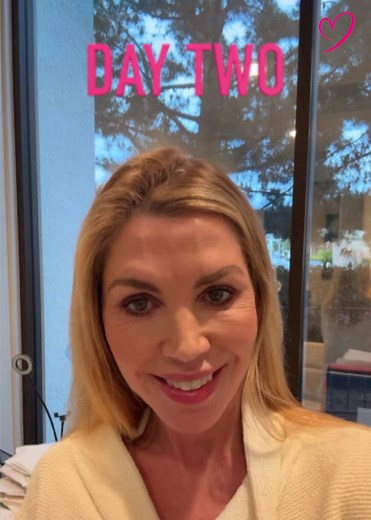 Armstrong MD Non-Surgical Facelift: What You Need to Know