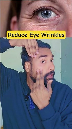 “How to Reduce Eye Wrinkles Fast | Remove Crow’s Feet Naturally | Anti-Aging Eye Care”