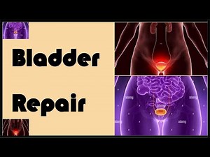Bladder Repair | Urinary Bladder Repair | Obstetrics and Gynaecology