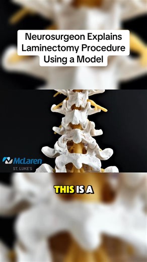 127K views · 1.3K reactions | Explanation of the surgical procedure done for spinal stenosis, a narrowing of the spinal canal | Dr. Brian Hoeflinger, MD | Facebook