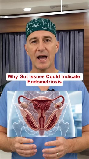 Did you know that gut issues could signal endometriosis? Many patients are misdiagnosed with IBS, missing crucial evaluations. Don't ignore symptoms like bloating, constipation, or unusual bowel habits. Get specialized care! Share your experiences or questions below! #Endometriosis #GutHealth #IBS #ChronicSymptoms #Bloating