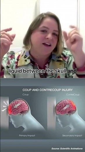 What is a contrecoup injury? 🧠 #brainhealth #braininjury #concussion #jelly