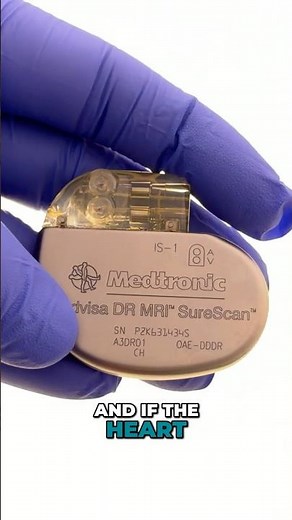 What Does a Pacemaker Actually Do? #cardiology #doctor #cardiacrehab