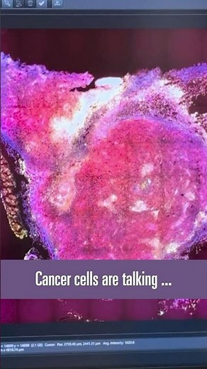Decoding the cellular language of cancer #Shorts #cancerresearch #science