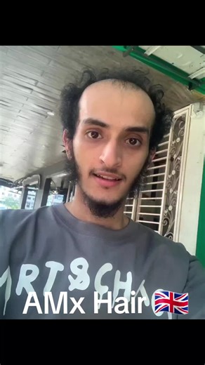 Celebrity Star Hair Reviews - AMx Hair 🇬🇧