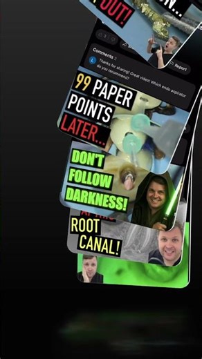 Dentist Reveals GP Point Fitting & Radiograph Process!