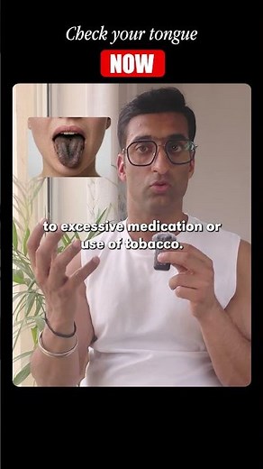 What your tongue color says about your health!