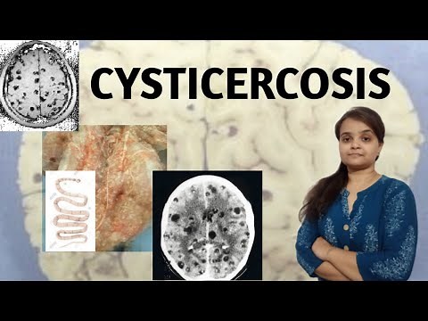 CYSTICERCOSIS
