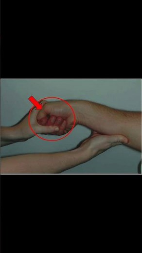 The Finkelstein test #education #medical #physiotherapy #medicine #patient #pain##wrist#deQuervain's