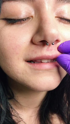 Professional Piercer Demonstrates Smiley and Septum Piercings