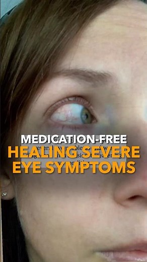 Medication-Free Healing Severe Eye Symptoms