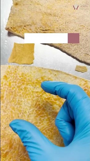 Showing How Thick REAL Human Skin Is