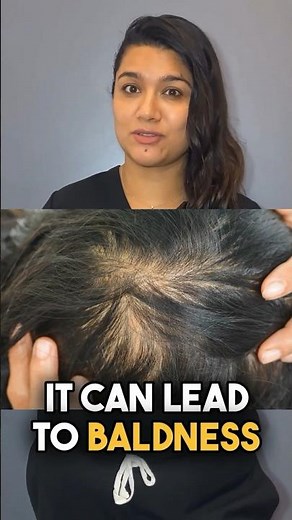 Female Hair Loss: Triggering Factors Explained by Dr. Aleena