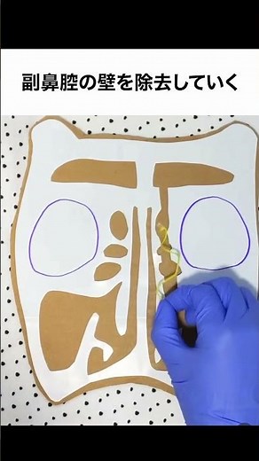 What is ESS nasal surgery like?? #OperatingRoomNurse #Beauty