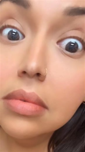 I have been suffering from blurry vision that has been worsening since chemo and now immunotherapy. Went to optometrist to see if I needed readers because I’m a bookworm and miss my books- found out I need bifocals because my eyes have aged 10years in 1 year due to treatment side effects. I have never had eye/vision problems before. Optometrist was worried about dilating my eyes due to angle in my eyes narrowing and didn’t want to risk them collapsing so I was sent to specialist for safe dilatio