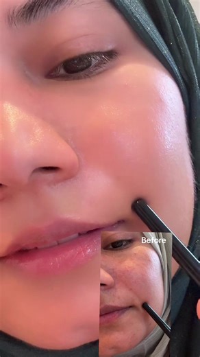 Transform Your Skin with SEOUL 1988 Advanced Shot