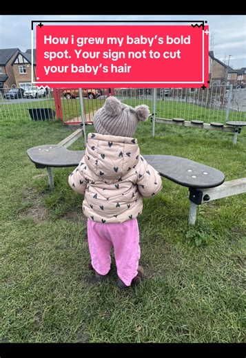 Transforming My Baby's Bold Spot: Hair Growth Journey